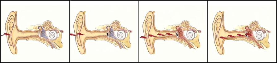 噪音经过外耳的耳壳、耳道及耳膜进入中耳及内耳图